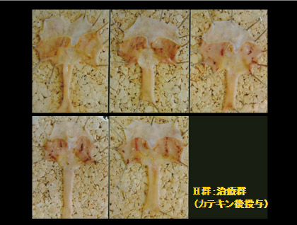 H群:治療群(カテキン後投与)