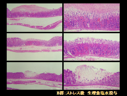 Ｂ群：ストレス後、生理食塩水投与