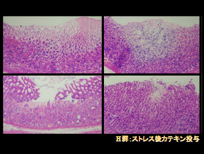 H群:ストレス後、カテキン投与