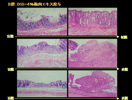 写真6:B群の大腸の組織学的所見